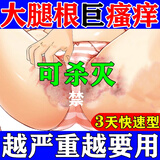 阴囊潮湿专用药男私处蛋蛋痒用什么药真菌感染皮肤用药男人下体私处瘙痒睾丸痒疼药止痒药膏硝酸咪康唑乳膏 1盒【股藓大腿内侧真菌感染腹股沟股癣】股癣专用药膏