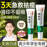 BEAI祛痘膏去痘痘和青春痘痘坑修复粉刺青少年初高中生男女30g