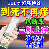 北京协和医学院止痒膏止痒抑菌皮肤瘙痒身体痒止痒特效湿炎皮疹真菌感染过敏药膏 100%特效一盒【止痒特效喷雾剂】 炉甘石抑菌百草止痒王去根湿毒清