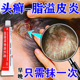 扬子洲头皮癣头癣特用药头皮痒脂溢性皮炎头癣真菌感染头皮屑瘙痒头皮痒止痒毛囊炎头部专用药头藓硝酸咪康唑乳膏 1盒装【头癣脂溢性皮炎专用药膏】