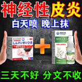 岩井昃弘日本进口神经性皮炎专用的顽固药膏皮肤瘙痒止痒中药无激素药膏 一盒喷＋一盒抹【效果翻倍】 日光过敏性湿疹皮癣真菌王感染
