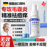 BEAI毛囊炎头皮长痘痘非药膏特止痒抑菌效除螨净喷剂非洗发水 30ml