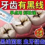 藤石制药牙菌斑可搭牙膏去i牙齿黑线黑渍牙窝沟牙膏去黑线牙齿发黑去斑HW 送牙刷【单盒装】牙齿黑线牙菌斑