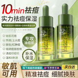 维特丝愈创木祛痘控油修护保湿乳液淡化痘印去痘痘收缩毛孔男女士护肤品