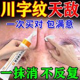 川字纹去除神器填充抬头纹去除男女重度去皱纹去法令纹贴睡觉贴膏 【赋颜抗皱嫩肤霜】1盒