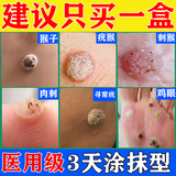 [森博伦]水杨酸软膏 5%*20g 1盒装 去疣刺猴专用的药刺猴子寻常疣鱼鳞痣专用药刺瘊子去除特新效期药肉刺痣瘊疣育脚刺猴 刺猴疣猴去除药膏国药正品