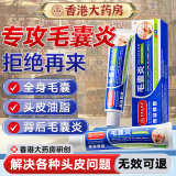 香港大药房有限公司毛囊炎膏去屑止痒头皮痒脂溢性皮炎头部严重专用非酮康唑洗剂发水