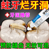 乔记本草防蛀牙膏蛀牙洞修复龋齿儿童医用含氟牙膏龋齿烂牙牙洞清理牙虫的 （药监备案）单盒装【牙医推荐】