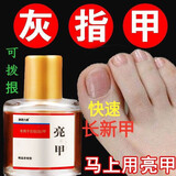 【亮甲官方旗舰店】亮甲亮甲快速长新甲灰指甲祛根专用液治灰指甲药液增厚甲大药房直发 一瓶装