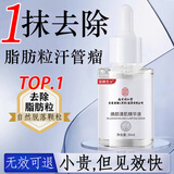 同仁堂脂肪粒去除神器眼部专用去眼部脂肪粒眼袋清肌颗粒眼部精华液30ml