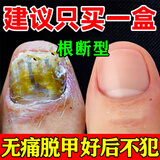 灰指甲特傚效专用的药指甲增厚发黄变厚变空真菌感染日本原装进口 1盒灰甲膏】要搭配正品有效 京东小店灰指甲用什么药好的快灰指甲专用大药膏房