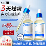 OHBT水杨酸果酸祛痘精华液50ml淡痘印痘坑修复收缩毛孔祛痘痘护肤品