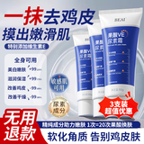BEAIBEAI果酸VE尿素霜维生素e乳改善干燥疙瘩毛囊角质身体乳保湿滋润