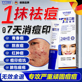 YYTISS祛痘药膏淡化痘印消除坑炎痤疮专用青少年去痘痘和痘印青春痘学生