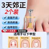 南京同仁堂甲沟炎矫正器嵌甲矫正器垫片神器脚趾甲专用指甲刀药贴片长在肉里 甲沟炎专用矫正器京【2个装】 甲沟炎填充垫片剔甲器指甲剪