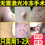 医美霖清赘点痣膏脸部可搭去痣去黑痣美容院专用点痣点疣祛痣膏官方正品 1盒装