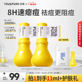 羽素祛痘大灯泡3.0 航仔徐老师推荐 祛痘精华祛痘痘青春期去痘护肤品