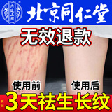 北京同仁堂生长纹少年专用医用凝胶青少年学生大腿肥胖纹膏儿童去除修复神器 3盒【轻中度生长纹】疗程装