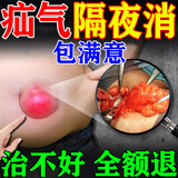 奕康本草婴儿脐疝贴带婴儿0-3个月肚脐疝气贴带腹股沟婴儿专用老人医用药 特效【单盒装】 毕生研究疝气一贴好