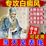 乔记白癜风遮盖液神器白斑皮肤病修复膏白癜风专用非药促进黑色素生长 308(100%发货特效)5送4【包满意】无用全退 白癜风遮盖液100%成功去除白斑消白(非进口)软膏