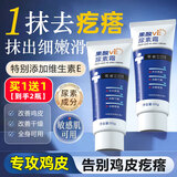 KOOGIS果酸VE尿素霜维生素e改善润肤保湿鸡皮疙瘩手足防干裂去角质乳膏