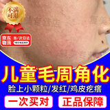 鸡皮肤疙瘩毛囊角化症专用非药儿童脸部身体毛周角化疙瘩颗粒去除 维E特效霜儿童鸡皮肤疙瘩闭口粉刺克星