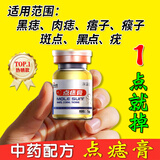 点痣膏水疤痕修复脸部去痣点痣膏官方正品祛斑点斑专用非药点疣水 1盒普通装【点痣膏】