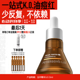 毕生之研五环精华液3.0-15ml祛痘控油点痘淡红油橄榄油皮油痘肌修护女男
