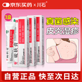 川石 硫软膏10g*3盒杀菌止痒消炎脂溢性皮炎红肿瘙痒疥疮头癣祛螨虫痘痘痤疮阴虱酒糟鼻专用药膏非硫磺软膏