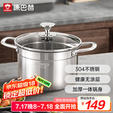 康巴赫304不锈钢汤锅双耳汤锅炖锅可视锅盖22cm电磁炉明火通用TOUC22A1