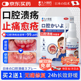 久卜制药口腔溃疡喷剂散凝胶口疮舌头起泡喷雾搭贴含片西瓜霜 30ml/瓶