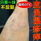 严静舒神经性皮炎专用的药医药顽固皮肤瘙痒止痒膏药皮炎湿疹皮癣真菌感染止痒身上痒越抓越痒复方醋酸地塞米松乳膏 1盒国药OTC皮肤用药】湿疹药膏十大牌子发货特效快