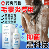 毛囊炎沐浴露后背部长痘痘马拉色菌痤疮湿疹皮炎止痒抑菌神器洗液 【第二件五折】不再苦恼