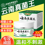 悠颐宝云南真菌王手足脚气水泡脱皮止痒膏皮肤抑菌全身止痒脚后跟开裂乳
