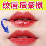 藤石制药医美专用】纹唇后专用修复润唇膏固色唇膏修复液反色漂唇修复膏BD 【5盒】疗程装