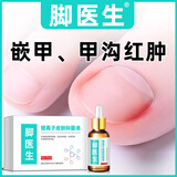 Dr.JYS脚医生甲沟炎专用液20ml消肿息肉芽红肿指甲嵌甲矫正甲沟炎矫正器