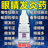 眼药水消炎止痒杀菌干涩疲劳发痒红血丝结膜炎眼睛发炎过敏异物感怕光流泪眼睛疼硫酸锌尿囊素滴眼液 1盒装【眼痒流泪干涩红血丝】
