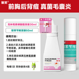 丽芙克林霉素磷酸酯脂外用溶液1%*30ml+洛芙联苯苄唑溶液60ml+药用喷雾剂泵1个祛痘印前胸后背毛囊炎