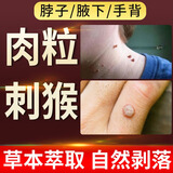 森卓止尤净跖疣专用非药脚底趾疣根鸦胆子脚上疣体肉刺祛疣去除非药膏 【肉粒猴子】1盒装蓝色去尤乐
