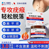 久卜制药疣体脱脱落膏去疣扁平疣专用丝状疣尖锐湿疣跖疣祛疣型疣瘊 1盒