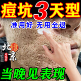 痘印痘坑修复凹洞祛痘去痘印去闭口粉刺去黑头痘坑男士祛痘疤膏药 (发货特效)买2送1【痘坑痘印凹洞】可试用 去痘痘和痘印淡化消除填充再生凝胶生长因子女男生医用