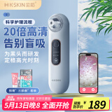 金稻可视化黑头吸出器吸黑头清理神器去黑头仪器粉刺毛孔清洁器黑头铲脸部清洁仪送男女生日520礼物 KD806 1个