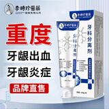 外医堂牙科分离剂牙膏状牙龈萎缩牙齿松动固齿修复再生牙周炎专用正品 3盒【巩固装】李时珍护牙小银管 【官方旗舰】护龈凝胶药自选联营