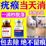 疣清宁去除疣体药膏扁平疣丝状灵脖子上小肉粒专用猴子颈瘊子面部点痣药 医用祛疣组合液+膏1盒【日本】 神器水优肤平hpv脱落膏祛疣口进