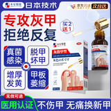 本安制药灰指甲专用指甲真菌感染脱甲坏甲抑菌液重度灰指甲1盒