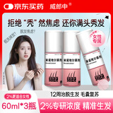【女士专研款】威郎中 米诺地尔搽剂2%浓度*60ml*3瓶 女性育发生发发际线增长液 温和头皮敏感专用严重脱发斑秃产后脱发