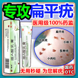 臣功维A酸乳膏去疣医用去疣膏去疣体瘊子扁平疣一抹疣瘊灵去灵除脖子上的小肉粒软膏扁平疣脸部丝状疣专用药颈部 1盒【皮肤用药祛疣祛痣脱落膏100%发货特效非进口