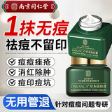 同仁堂草本祛痘膏去痘膏痘痘疤痘坑修护痘肌闭口粉刺青春痘20g七夕