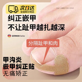 OEMG 甲沟炎矫正器贴片甲沟炎垫片隔离贴正甲贴嵌甲器手指甲垫棉神器 甲沟隔离贴【无痛正甲贴】 【10张装/40贴】