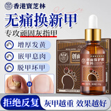 宝芝林灰指甲杀菌液灰指甲专用指甲真菌感染脱甲坏甲发黄增厚变白脱甲膏